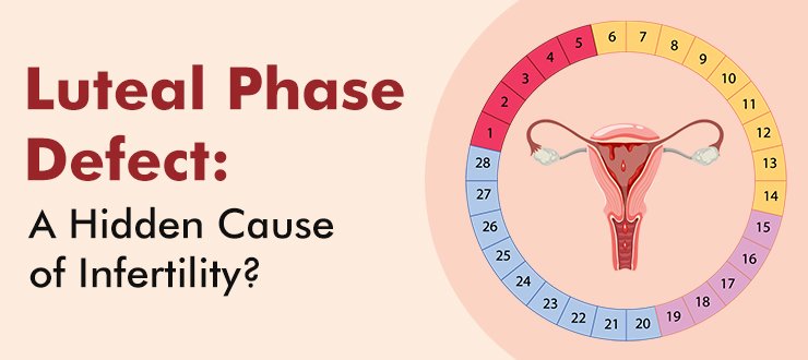 Luteal Phase Defect: A Hidden Cause of Infertility?